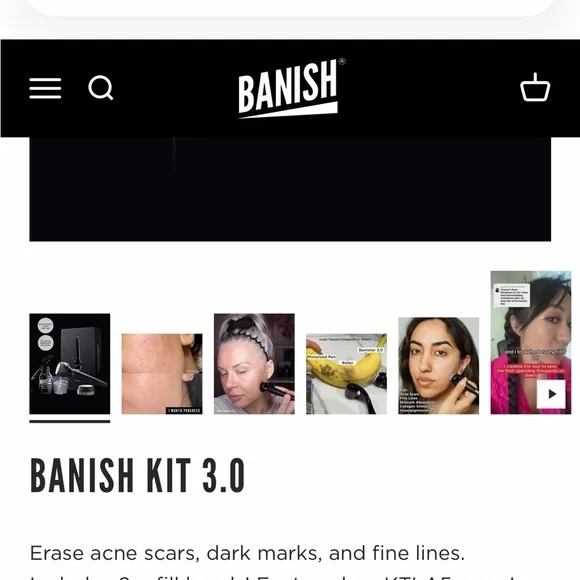 NEW @ home Microneedling Kit - Picture 2 of 9